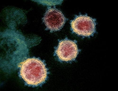 日本新冠病毒最新爆料,疫情反弹，防疫措施再升级！”